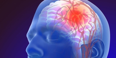 Условия, которые меняют работу Вашего мозга