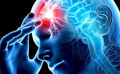 Мигрень: причины, симптомы, лечение