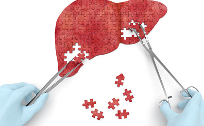 Заболевания печени и пути их лечения