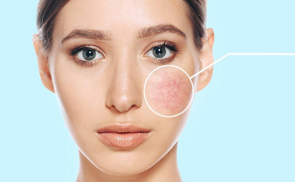 Азелаиновая кислота: воздействие на кожу, решаемые проблемы и рекомендации по использованию