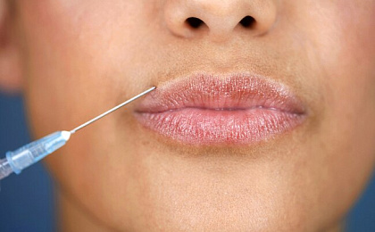 Филлеры - что это?