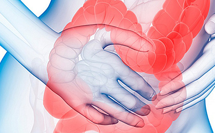 Синдром раздраженного кишечника