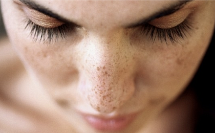 Косметические средства от пигментных пятен: состав, польза и побочные эффекты