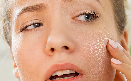 Самые распространенные вопросы о чувствительной коже