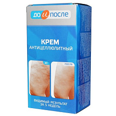 До и после Антицеллюлитный крем 100 мл